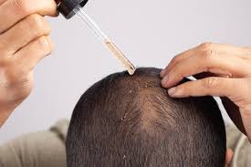 Dandruff Treatment